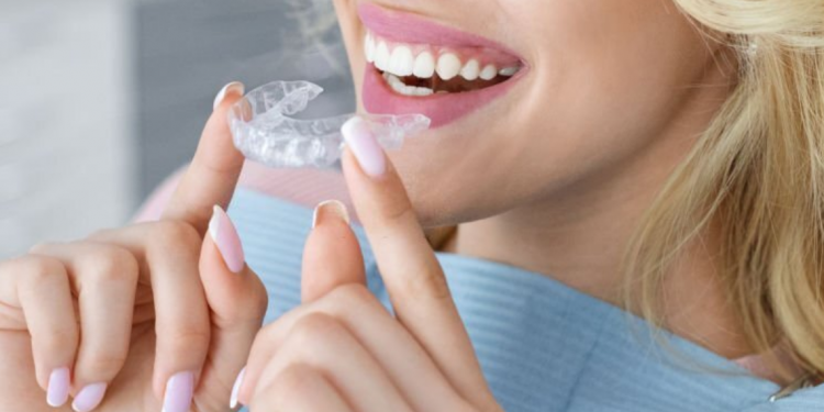 Invisalign cost Winnipeg