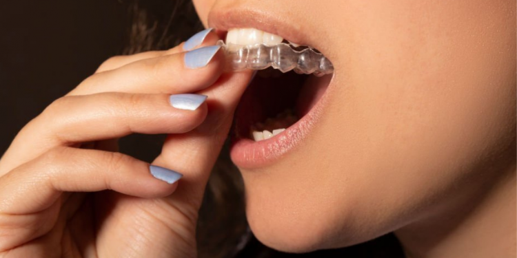 Invisalign